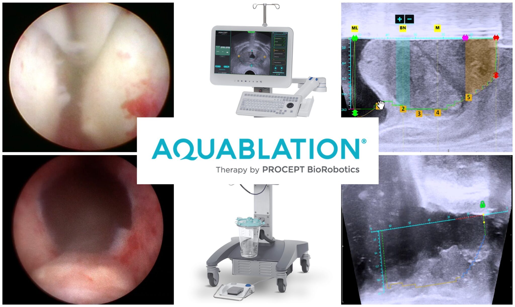 合併症のリスクを軽減するためにできること